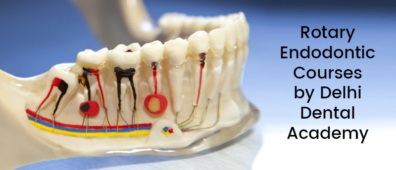 Rotary Endodontic Courses by Delhi Dental Academy, Dental Courses in Delhi, Dentistry Courses, Dental Clinical Courses in Delhi, Endodontic Courses in Delhi