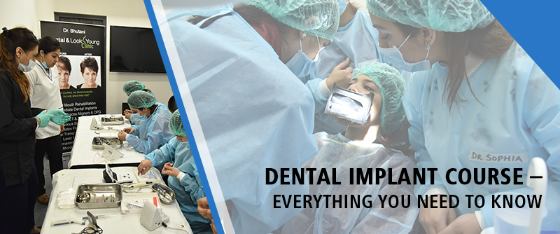 Dental Implant Course – Everything You Need To Know