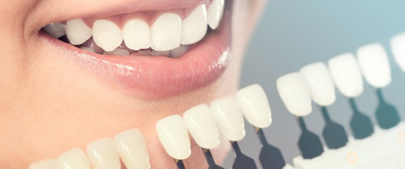 Role of a Prosthodontist in Cosmetic Dentistry