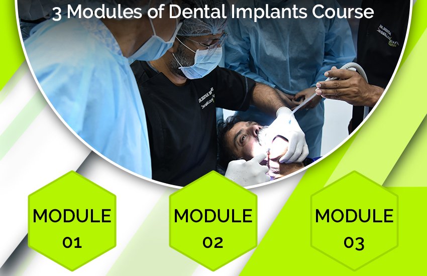 3 Modules of Dental Implants Course